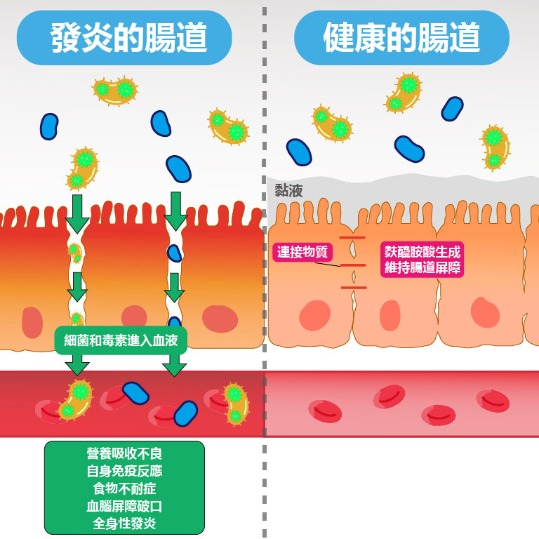 腸漏症-成因與預防-發炎的腸道-健康的腸道